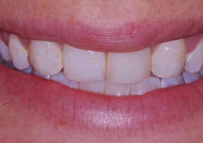 General Dentistry in Burtonsville